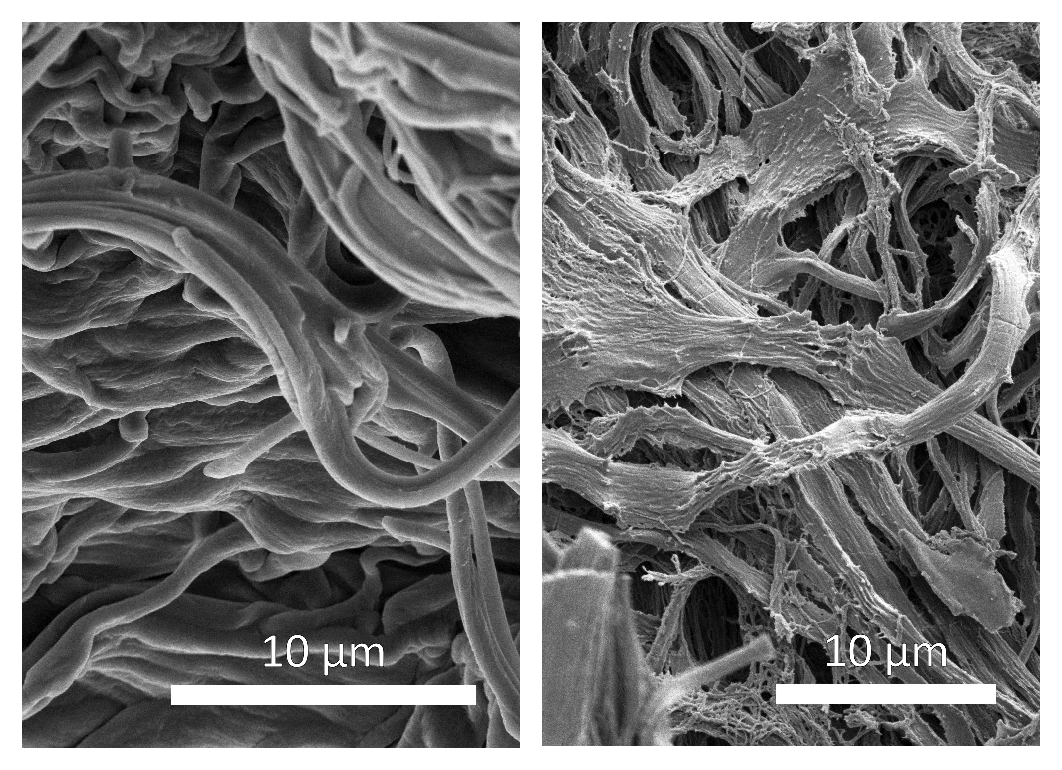 Elastinfasern Protein Fraunhofer IMWS